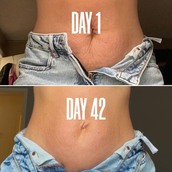 Pregnancy Stretch Marks Butter - Restore & Renew