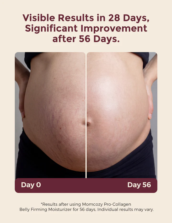 Pregnancy Stretch Marks Butter - Restore & Renew